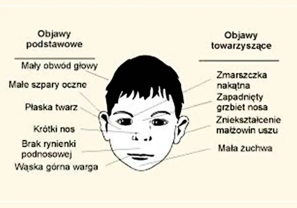 Znane osoby z FAS - Kto naprawdę ma diagnozę?