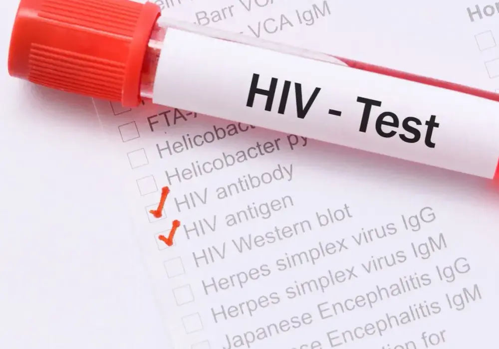 Objawy HIV u kobiet - często mylone. Kiedy zrobić test?