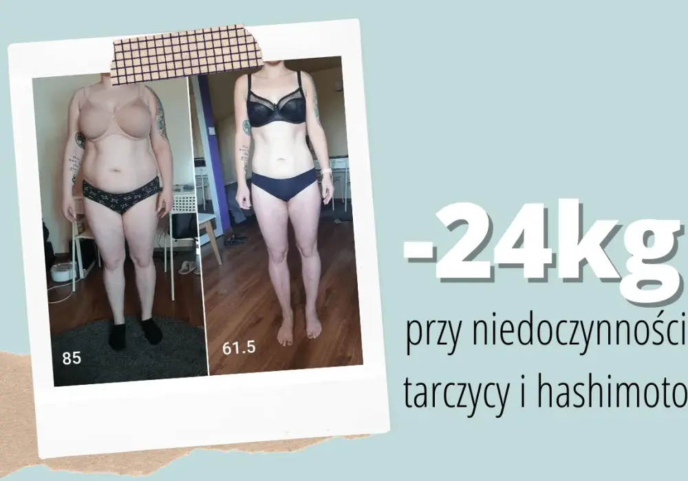 Niedoczynność tarczycy - Waga stoi? Co robić, by schudnąć