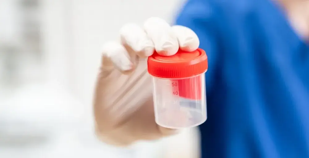 Ile kosztuje test na narkotyki w laboratorium? Ceny w różnych miastach
