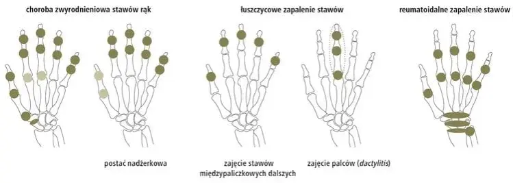 Jakie badania na oddziale reumatologii? Poznaj kluczowe testy diagnostyczne