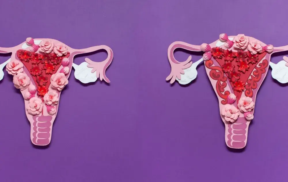 Bolesne miesiączki - czy to adenomioza? Objawy, diagnoza, leczenie