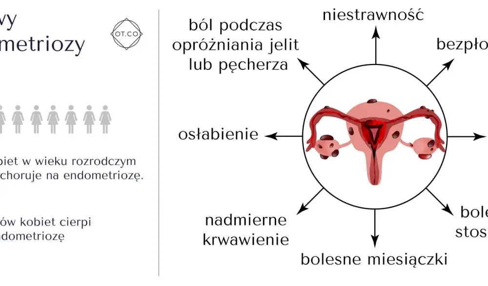 Operacja endometriozy - Kiedy warto i czego się spodziewać?
