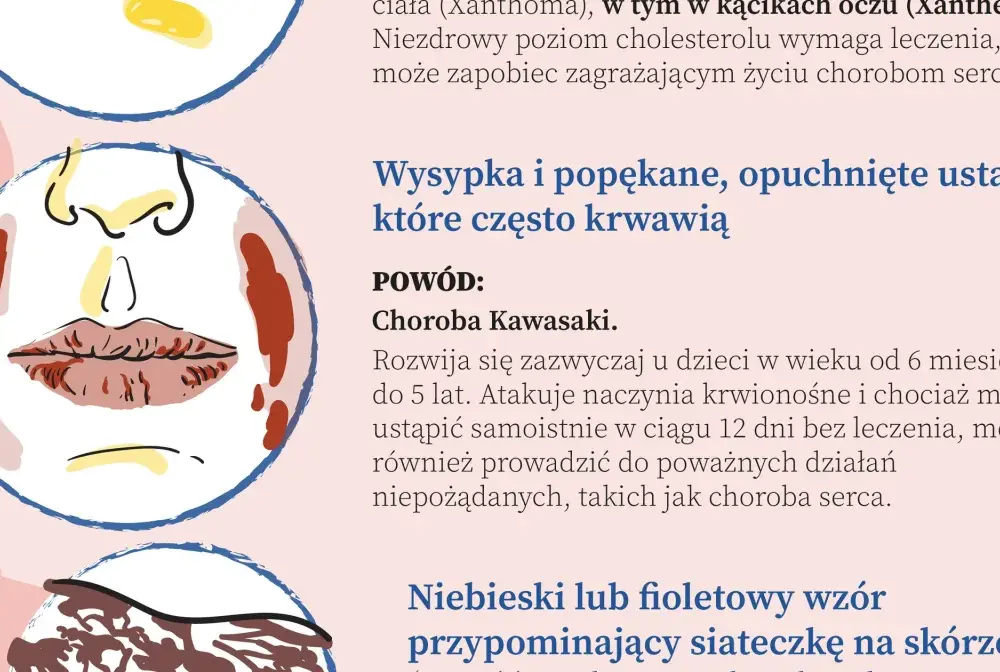 Choroby serca - objawy, badania i profilaktyka