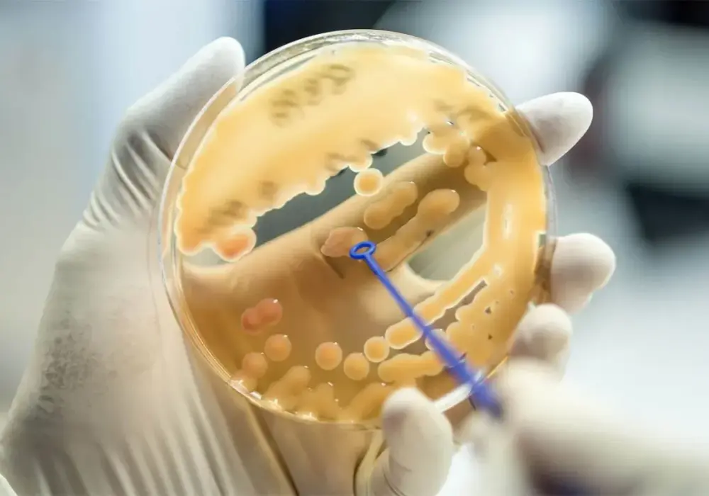 Co to jest laboratorium mikrobiologiczne i jakie ma znaczenie w diagnostyce?