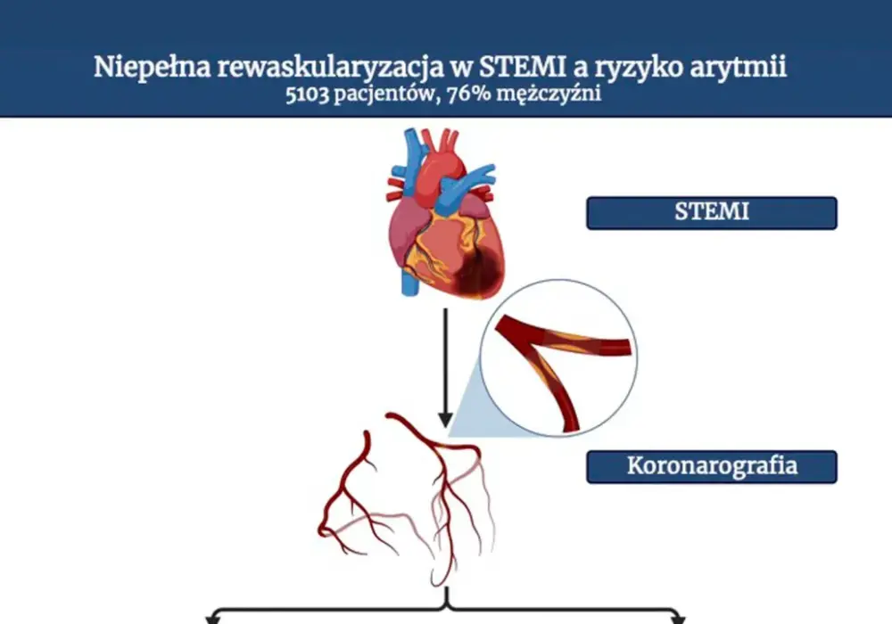 Rewaskularyzacja - Kiedy przywrócenie przepływu krwi ma sens?