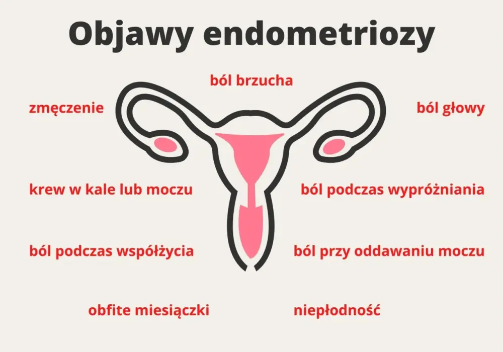 Endometrioza - Ból miesiączkowy to nie norma! Rozpoznaj i lecz.