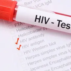 Test HIV z zaznaczonymi pozycjami "HIV antibody" i "HIV antigen". Wczesne objawy HIV u kobiet mogą być subtelne.