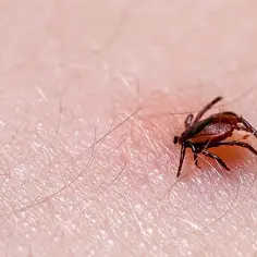 Zbliżenie na ludzką skórę z widocznym, brązowym kleszczem. Pajęczak ma osiem nóg i wyraźnie zaznaczone ciało. Wokół niego widać drobne włoski i pory skóry.