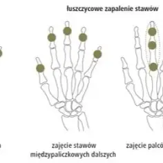 Jakie badania na oddziale reumatologii? Poznaj kluczowe testy diagnostyczne