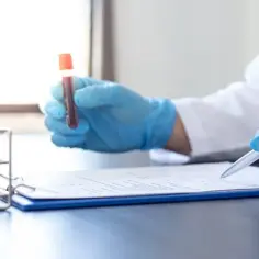 Czy laboratoria pracują w sobotę? Sprawdź, gdzie możesz się zbadać
