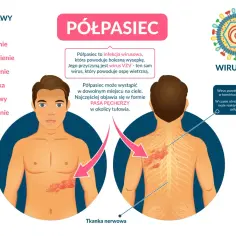 Objawy półpaśca: ból, pieczenie, gorączka. Szczepionka na półpasiec może zapobiec tej chorobie, która objawia się wysypką.