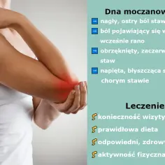 Ból łokcia z zaczerwienieniem i obrzękiem. Dna moczanowa to nagły, ostry ból stawu, często nocny. Leczenie: lekarz, dieta, styl życia, aktywność.