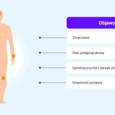 Objawy: zmęczenie, stan podgorączkowy, ból stawów. Czy metotreksat to chemia? To lek, który pomaga w leczeniu chorób autoimmunologicznych.