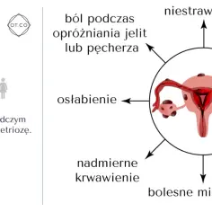 Grafika przedstawia objawy endometriozy, takie jak ból, mdłości, bezpłodność. Operacja może być jedną z metod leczenia.