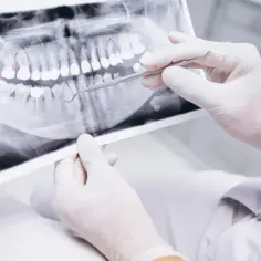 Dentysta analizuje zdjęcie RTG szczęki, planując sanację jamy ustnej. Czerwone zaznaczenia wskazują obszary wymagające uwagi.