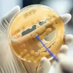 Co to jest laboratorium mikrobiologiczne i jakie ma znaczenie w diagnostyce?