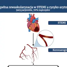 Schemat przedstawia serce, naczynia wieńcowe i proces koronarografii. Temat: niepełna rewaskularyzacja w STEMI.