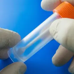 Jak prawidłowo pobrać kał na Helicobacter pylori - uniknij błędów