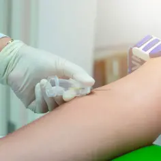 Jakie badania krwi są niezbędne do diagnozy chłoniaka?