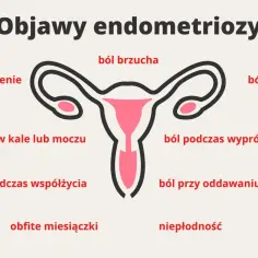 Grafika przedstawia objawy endometriozy: ból brzucha, zmęczenie, krew w kale lub moczu, ból głowy, ból podczas wypróżniania, ból podczas współżycia, ból przy oddawaniu moczu, obfite miesiączki i niepłodność.
