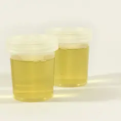 Jak przechowywać mocz przed oddaniem do laboratorium, aby uniknąć błędów