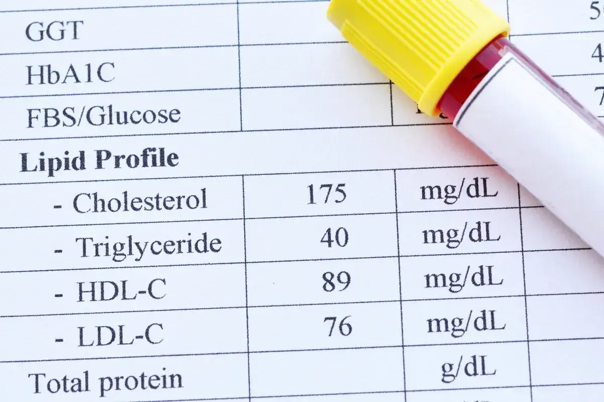 Wyniki lipidogramu: cholesterol 175, trójglicerydy 40, HDL-C 89, LDL-C 76 mg/dL. Nie hdl.