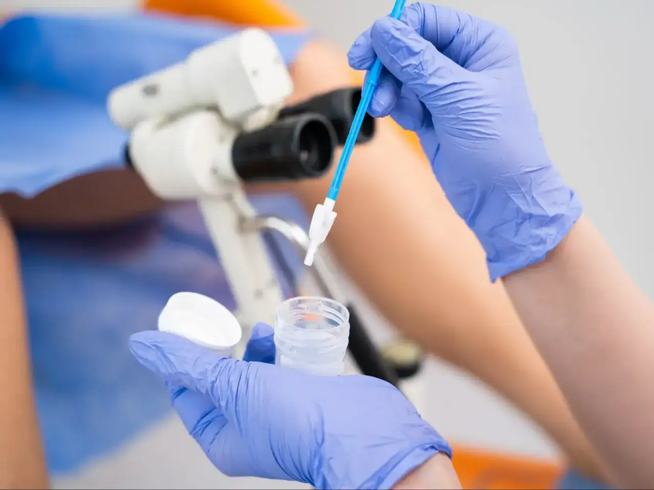 Rękawiczki medyczne przygotowują się do pobrania próbki do testu na HPV. W tle widać kolposkop.
