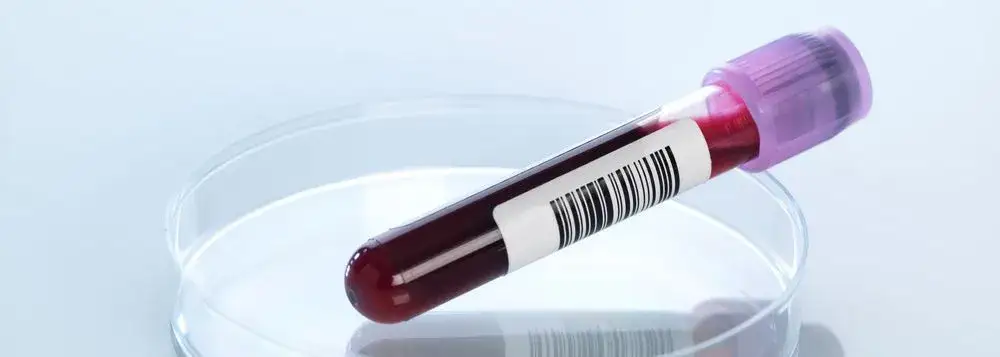 Zdjęcie Jakie badania na niedobory witamin pomogą uniknąć poważnych problemów zdrowotnych