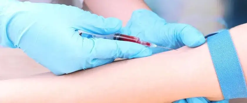Zdjęcie Dlaczego wątroba nazywana jest laboratorium chemicznym i co to oznacza?