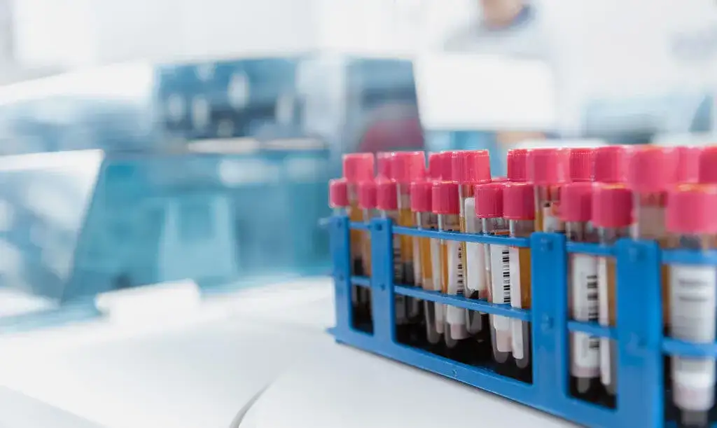 Zdjęcie Do czego służy probówka w laboratorium chemicznym? Odkryj jej zastosowania