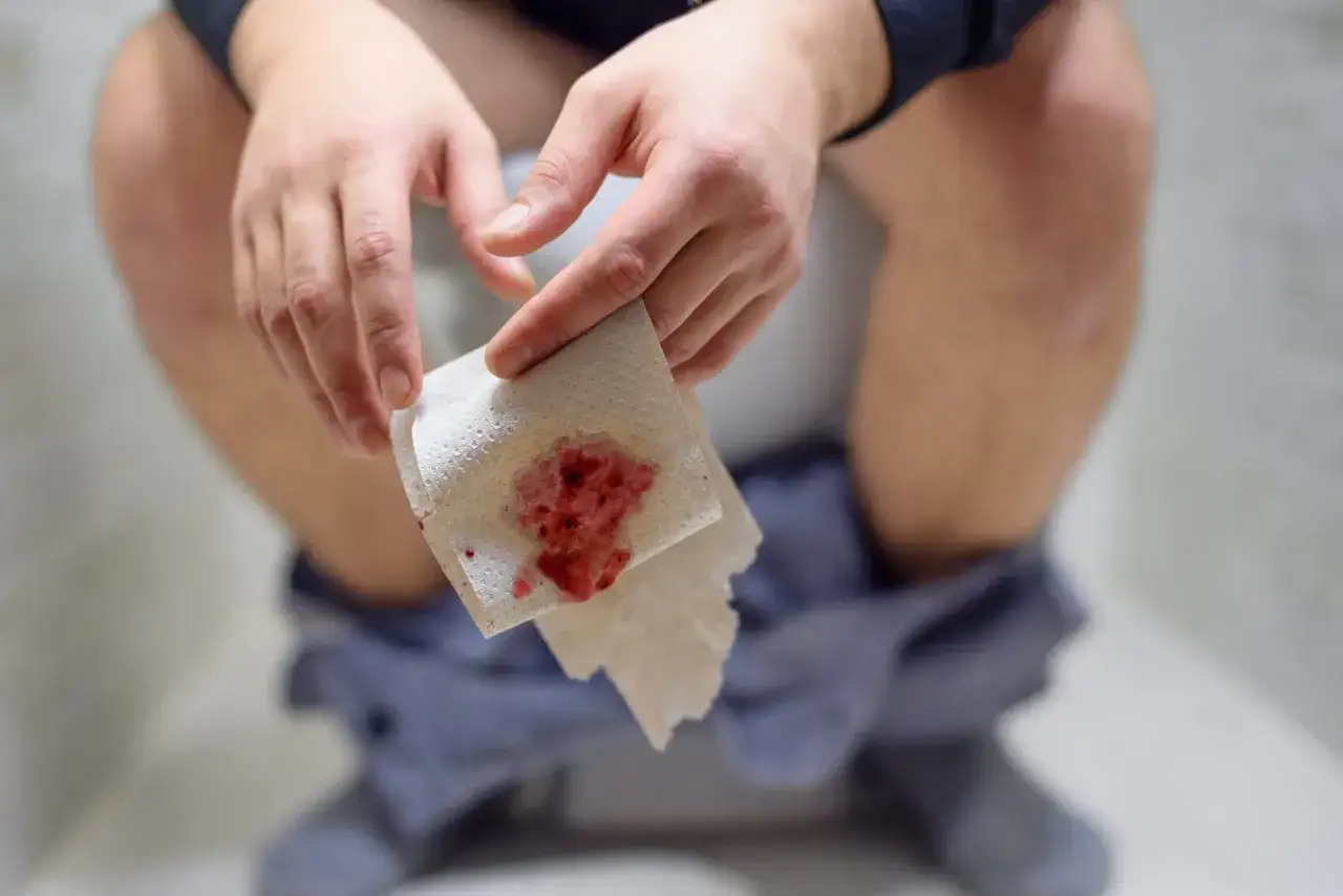 Dłoń trzymająca papier toaletowy z krwią, wskazujący na problemy z jelitami.