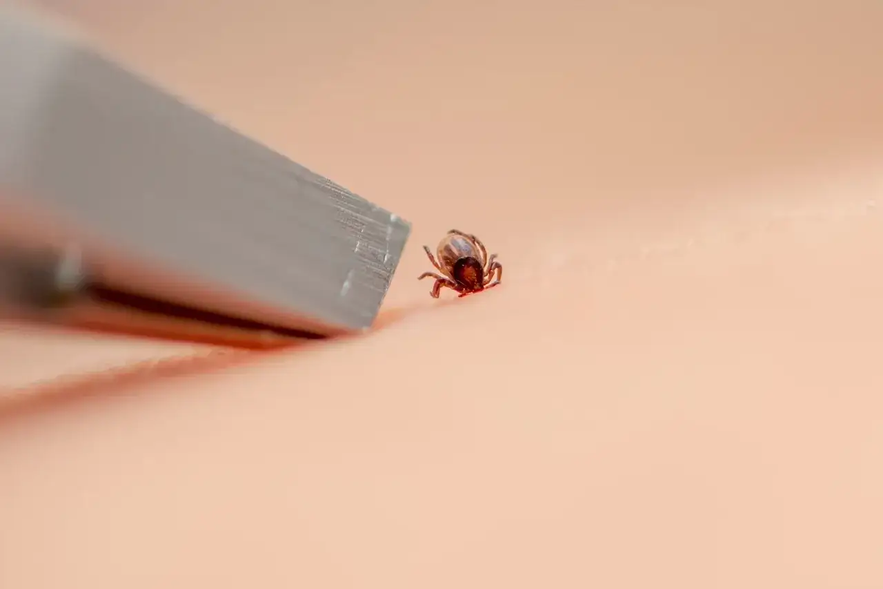 Mały kleszcz na skórze, tuż obok metalowego narzędzia, sugeruje potencjalne ukąszenie kleszcza i jego usuwanie.