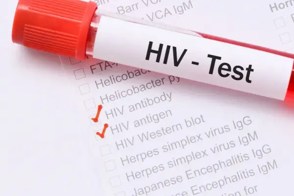 Objawy HIV u kobiet - często mylone. Kiedy zrobić test?