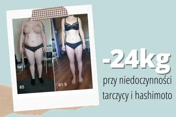 Niedoczynność tarczycy - Waga stoi? Co robić, by schudnąć
