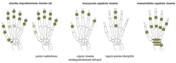 Jakie badania na oddziale reumatologii? Poznaj kluczowe testy diagnostyczne