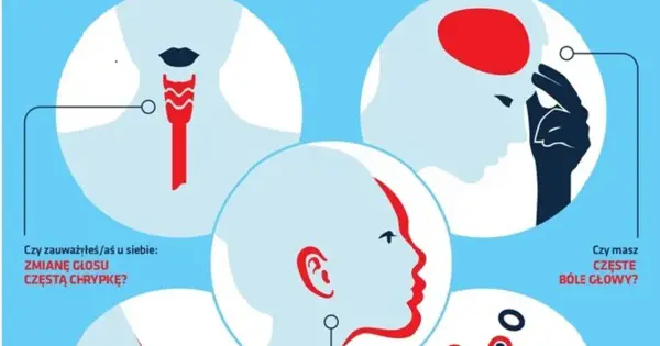 Akromegalia - objawy, które łatwo przeoczyć