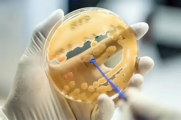 Co to jest laboratorium mikrobiologiczne i jakie ma znaczenie w diagnostyce?