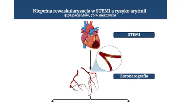 Rewaskularyzacja - Kiedy przywrócenie przepływu krwi ma sens?