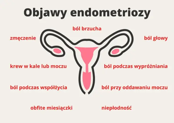Endometrioza - Ból miesiączkowy to nie norma! Rozpoznaj i lecz.